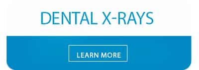 learn more about dental x-rays