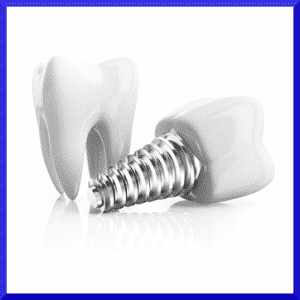 What can I eat with dental implants?