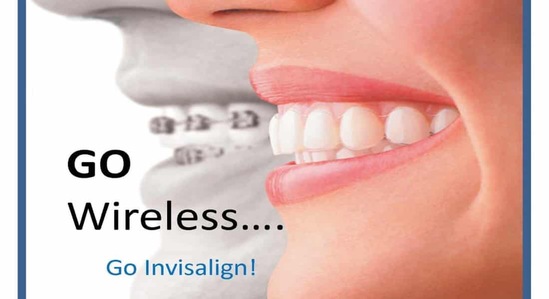 Smile Proudly! Straighter Teeth with Invisalign