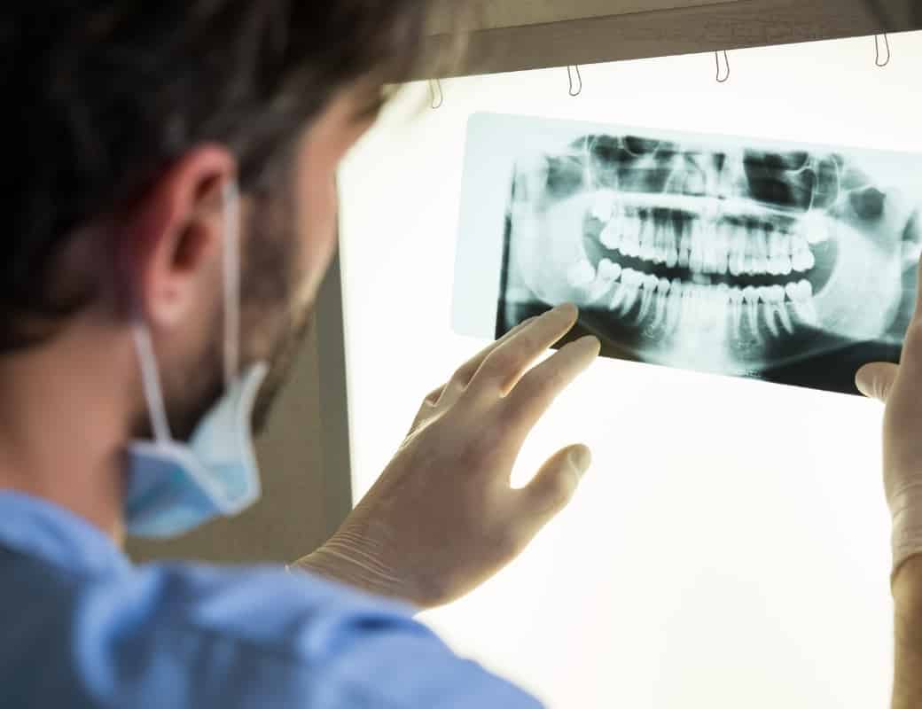 Everything You Need to Know About Dental X-Rays: